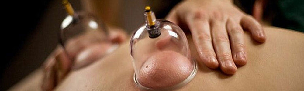 2 Cupping/Hijama